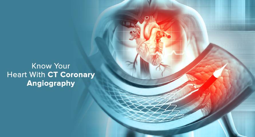 Dr Bhishma Chowdary cardiologist in Hyderabad