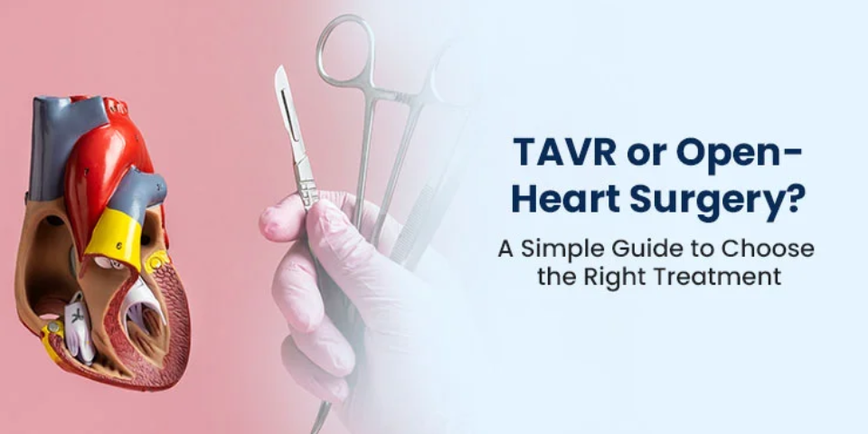 TAVR vs Open-Heart Surgery: Which Is Right for You?