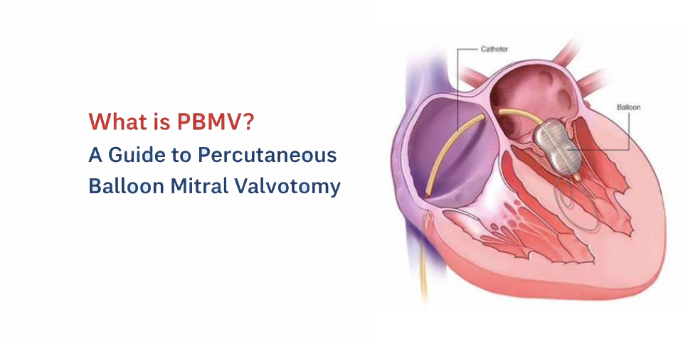 What Are Drug-Coated Balloons? The Stent-Free Heart Treatment in Hyderabad