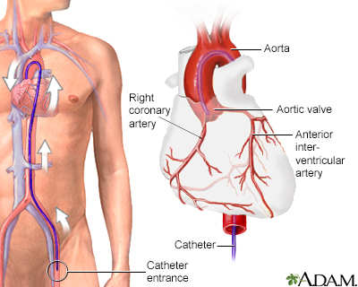 full-ecg.png